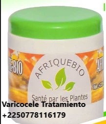 Varicocele Definición Causas Tratamiento Natural Varicocele