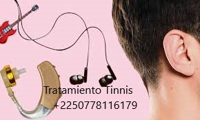 Tinnitus Definición Causas Tratamiento Natural Tinnitus